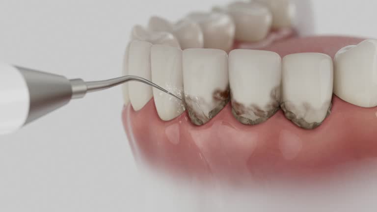 Reliable Dental contractor in Shafter, CA by Smile Center Dentistry